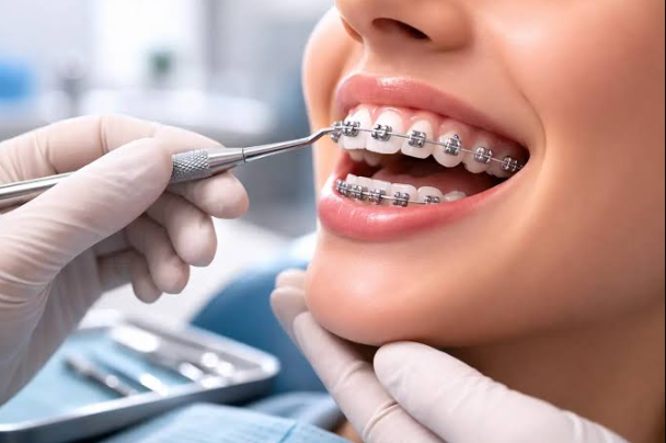 6 Ways To Keep Orthodontic Treatment Progressing During Extended Travel